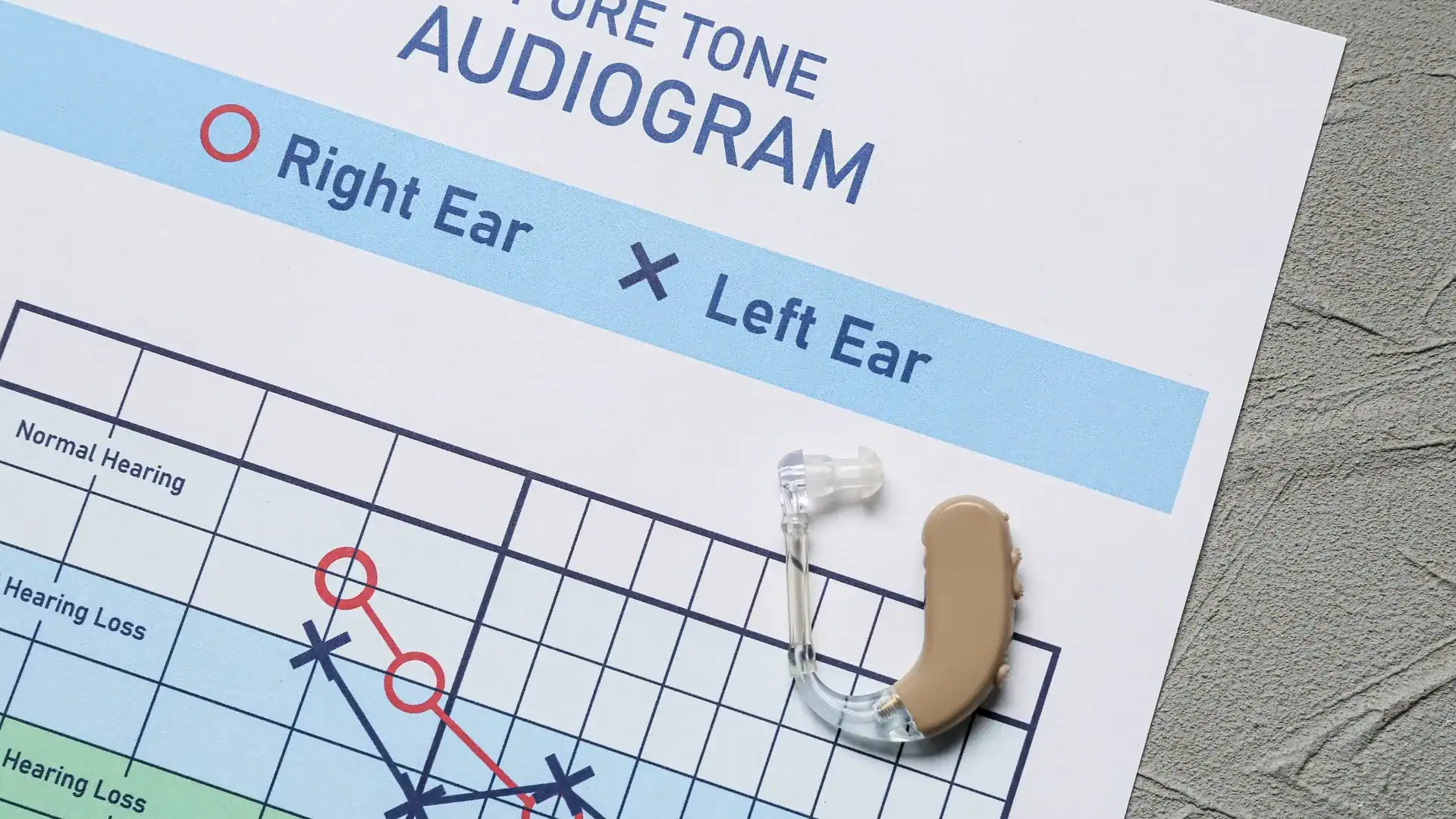 Featured image for “Understanding Audiograms and What the Results Mean”